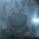 Illustration for article titled Andy Murray Shares Status Updates On His Hip, Dongem/em